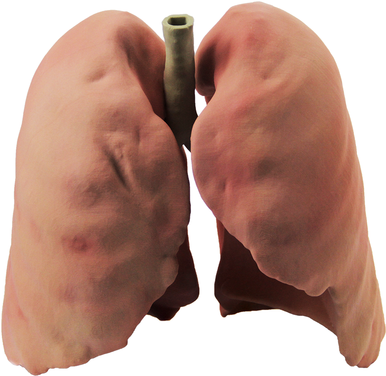 Lungs PNG Photos